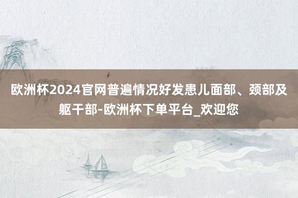 欧洲杯2024官网普遍情况好发患儿面部、颈部及躯干部-欧洲杯下单平台_欢迎您